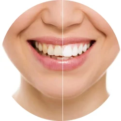 smile desiging smile desiging